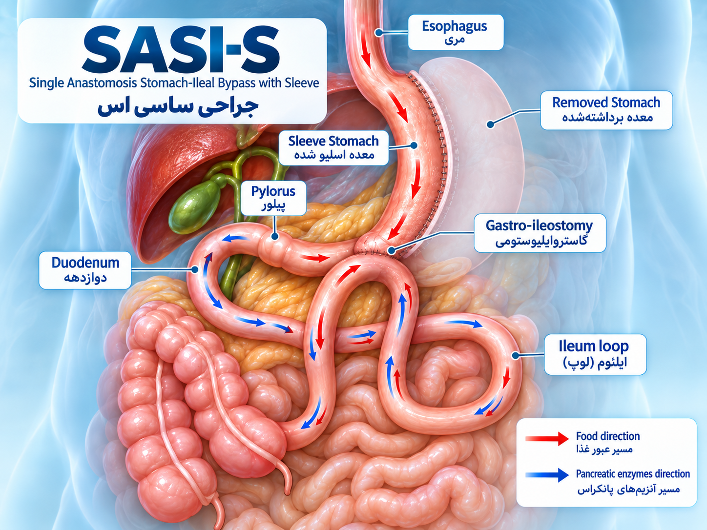آناتومی تأییدشده ساسی / SASI